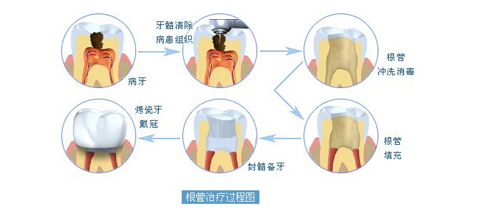 ίע헣